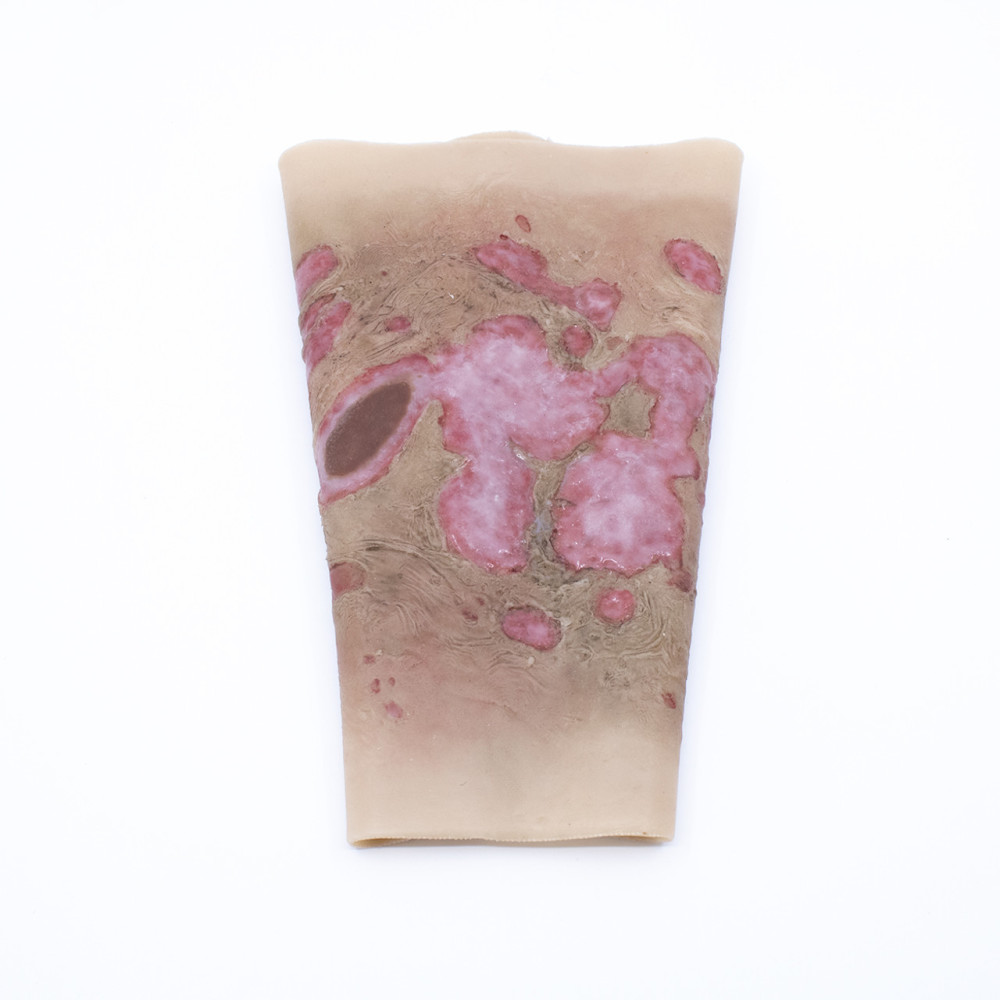 TRAUMASIM Wearable Large Burn - Forearm Image