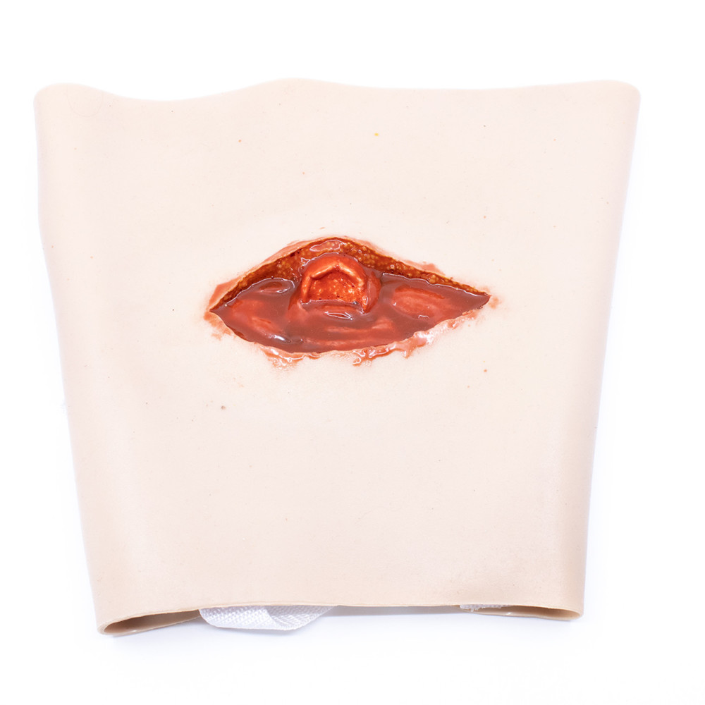 TRAUMASIM Wearable Open Femur Fracture - Upper Leg Image