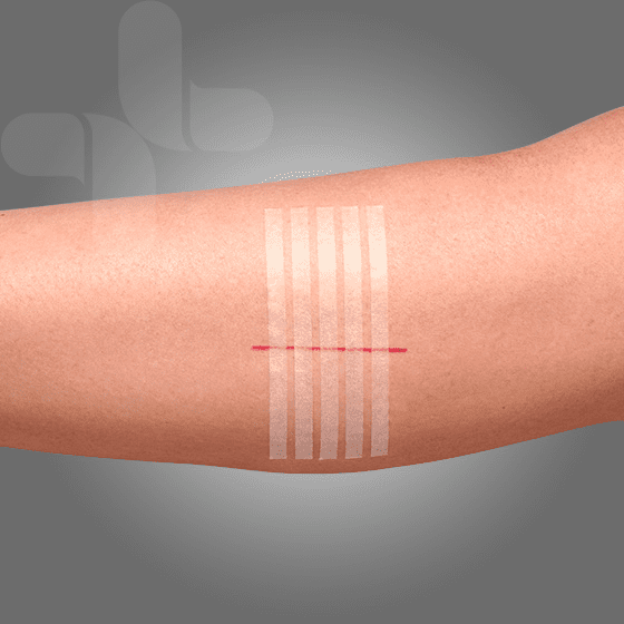 Image of AEROPLAST Wound Closure Strips 6 x 100mm Box/50 (10 strips/card)